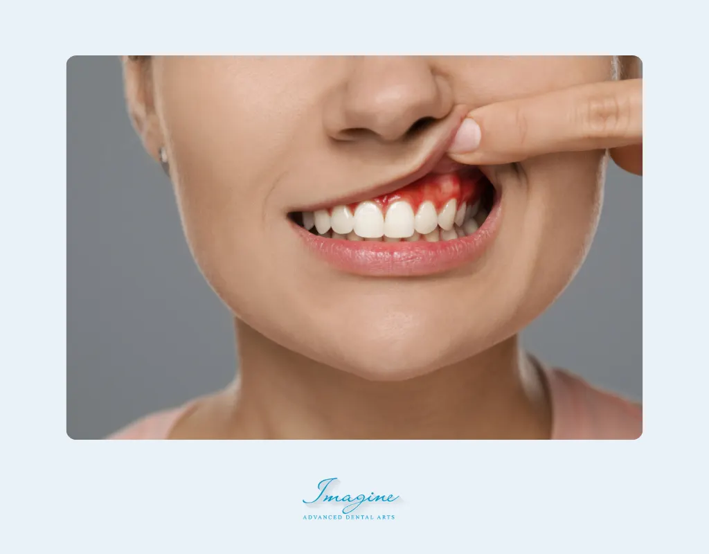 Gingivitis vs Periodontitis: What's the Difference and Why It Matters for Your Smile
