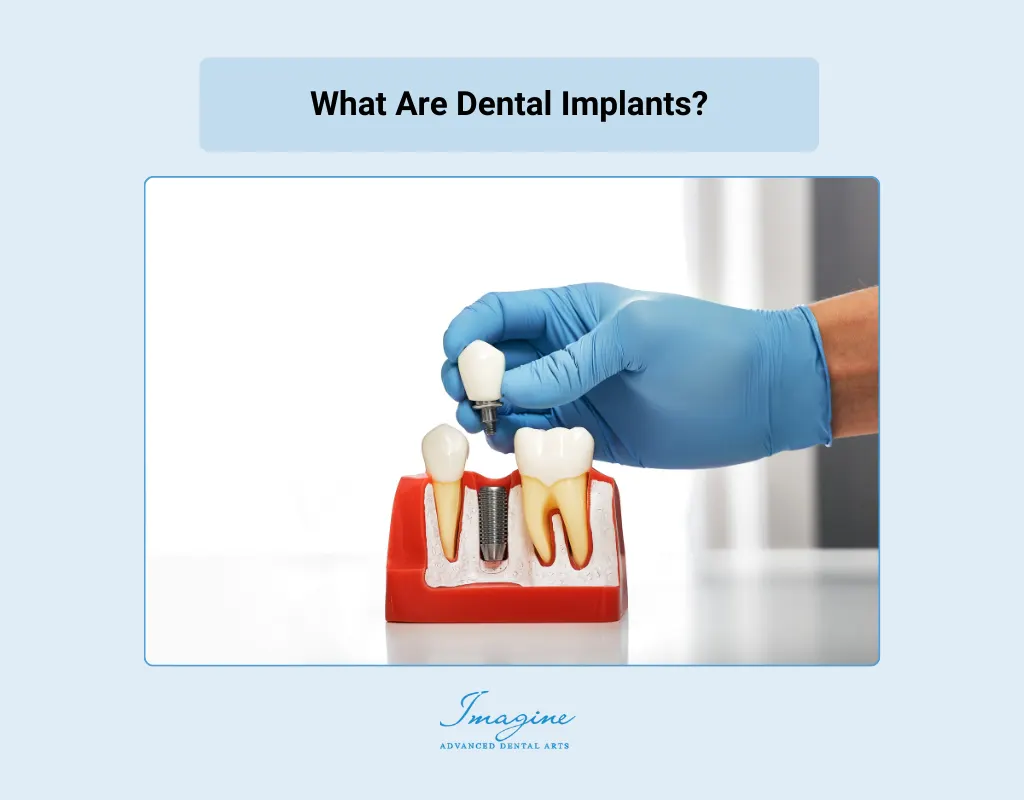 Pros and Cons of Dental Implants: A Detailed Overview