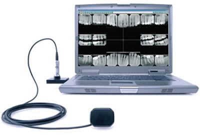 Digital dental X-rays